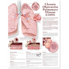 Chronic Obstructive pulmonary Diseases Chart (52x70cm) With Special Rigid Lamination and Plastic Rollers