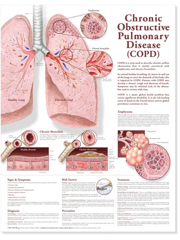 Chronic Obstructive pulmonary Diseases Chart (52x70cm) With Special Rigid Lamination and Plastic Rollers