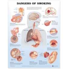 Dangers of Smoking Chart (52x70cm) With Special Rigid Lamination and Plastic Rollers