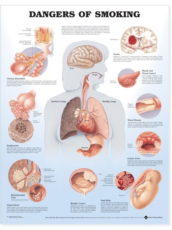 Dangers of Smoking Chart (52x70cm) With Special Rigid Lamination and Plastic Rollers