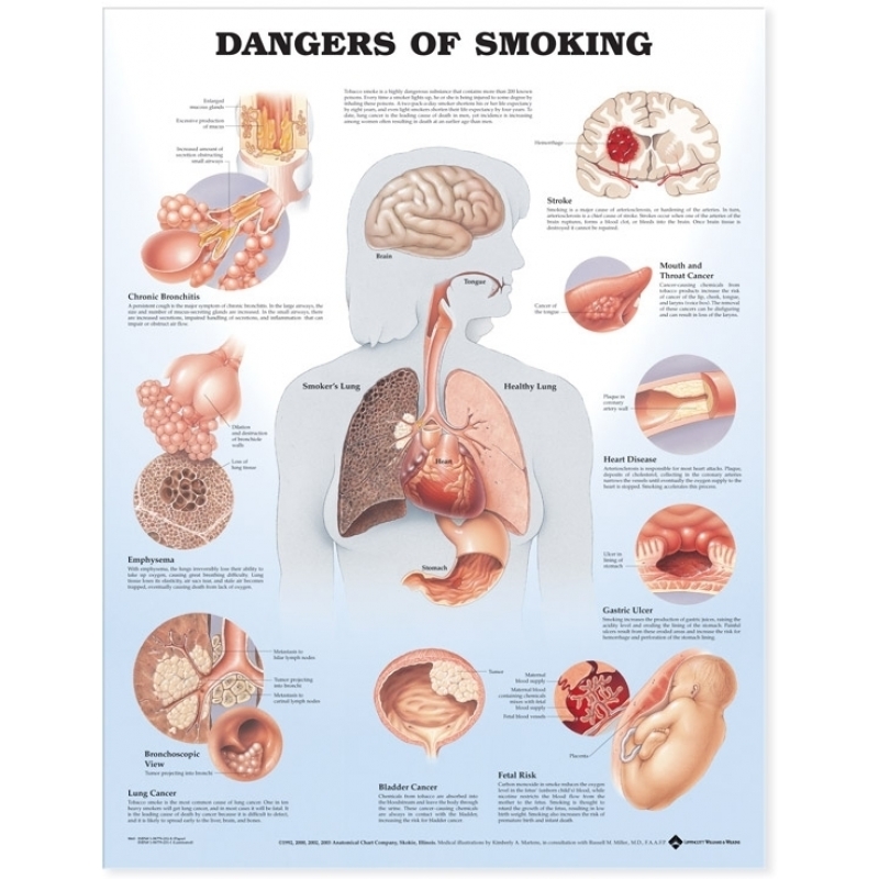 Dangers of Smoking Chart (52x70cm) With Special Rigid Lamination and Plastic Rollers