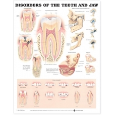 Disorder of Teeth and Jaw Chart (52x70cm) With Special Rigid Lamination and Plastic Rollers