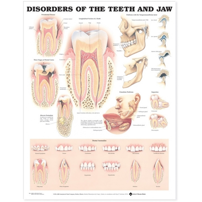 Disorder of Teeth and Jaw Chart (52x70cm) With Special Rigid Lamination and Plastic Rollers