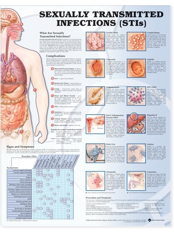 Sexually Transmitted Infections Chart (52x70cm) With Special Rigid Lamination and Plastic Rollers