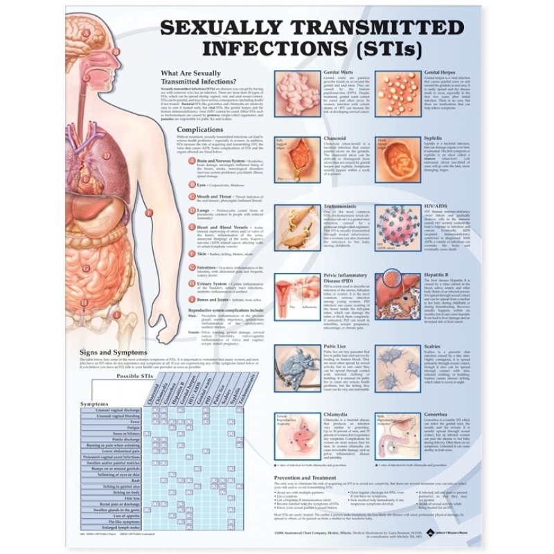 Sexually Transmitted Infections Chart (52x70cm) With Special Rigid Lamination and Plastic Rollers