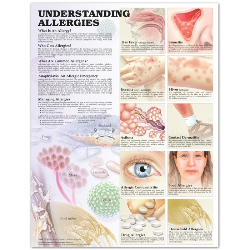 Understanding Allergies Chart (52x70cm) With Special Rigid Lamination and Plastic Rollers