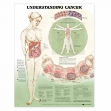 Understanding Cancer Chart (52x70cm) With Special Rigid Lamination and Plastic Rollers