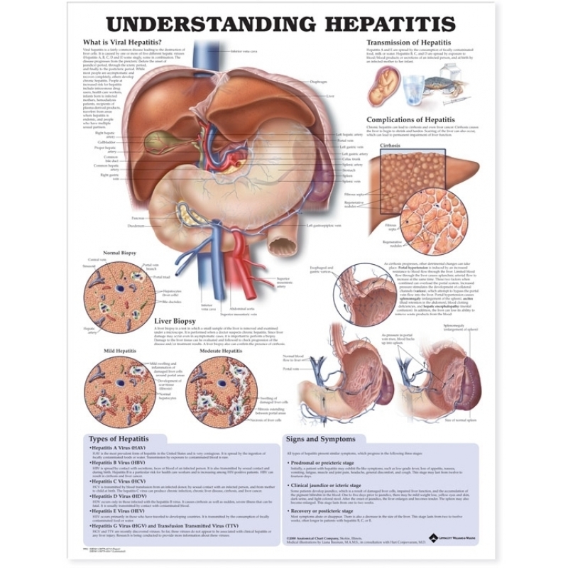 Understanding Hepatitis Chart (52x70cm) With Special Rigid Lamination and Plastic Rollers