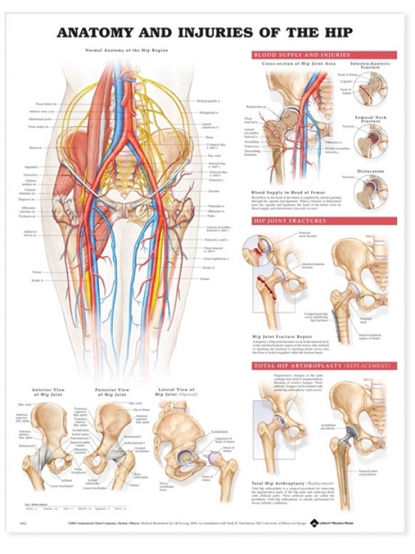 Anatomy & Injuries Of The Hip Chart (52x70cm) With Special Rigid Lamination and Plastic Rollers