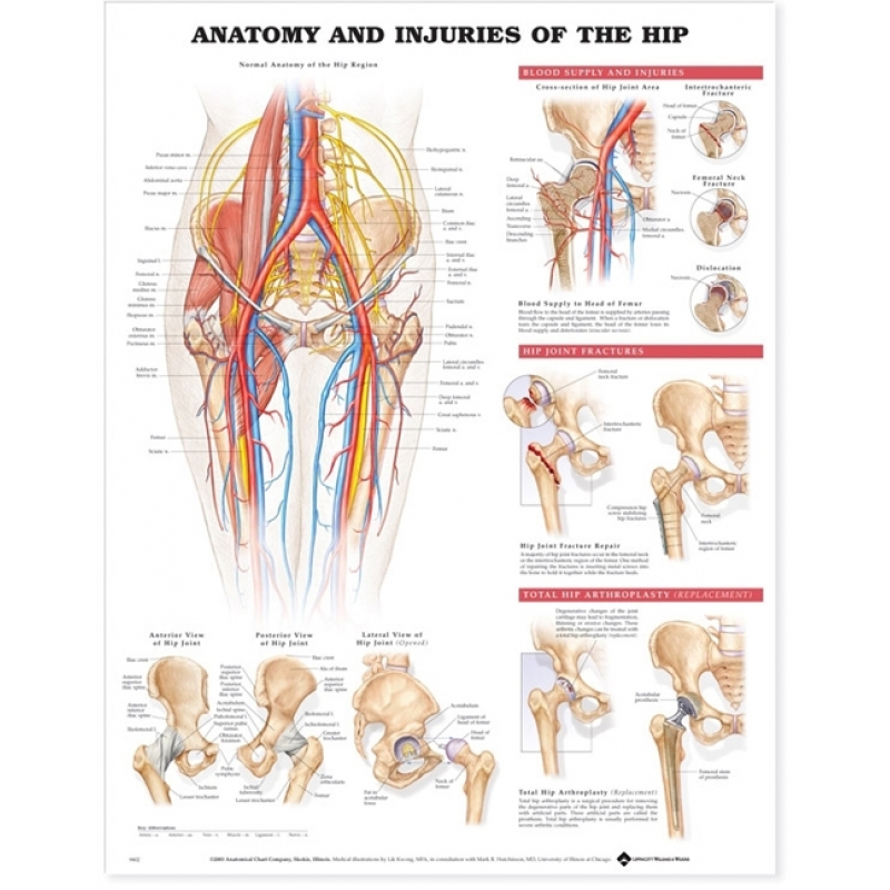 Anatomy & Injuries Of The Hip Chart (52x70cm) With Special Rigid Lamination and Plastic Rollers