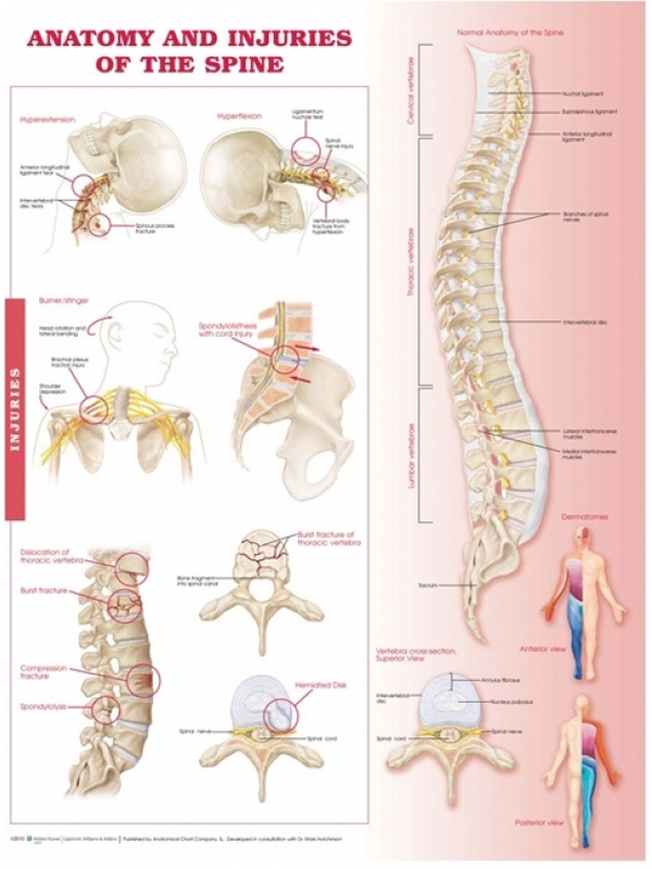 Anatomy & Injuries Of The Spine Chart (52x70cm) With Special Rigid Lamination and Plastic Rollers