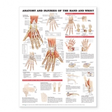 Anatomy and Injuries of The Hand and Wrist Chart (52x70cm) With Special Rigid Lamination and Plastic Rollers