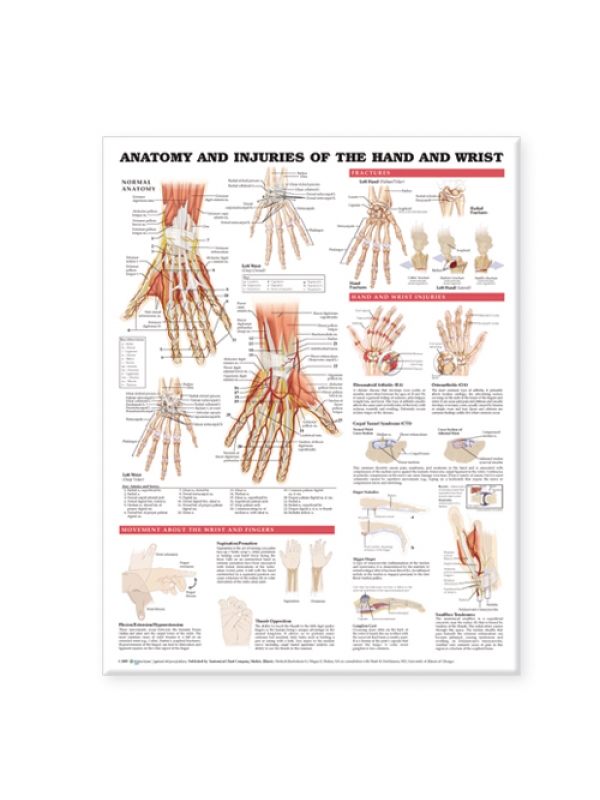 Anatomy and Injuries of The Hand and Wrist Chart (52x70cm) With Special Rigid Lamination and Plastic Rollers