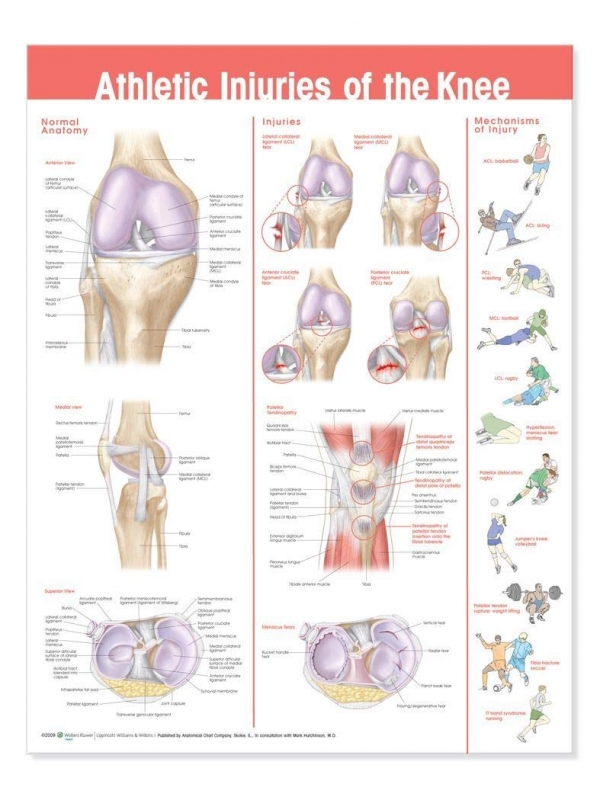 Athletic Injuries of Knee Chart (52x70cm) With Special Rigid Lamination and Plastic Rollers