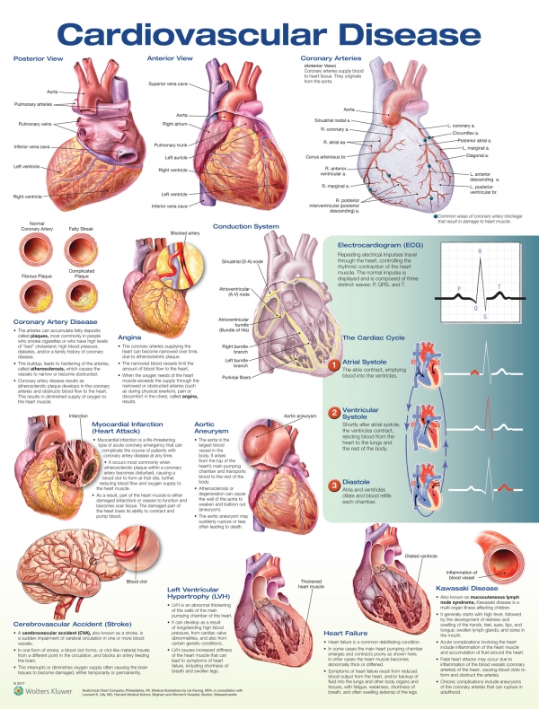 Cardiovascular Disease Chart (52x70cm) With Special Rigid Lamination and Plastic Rollers