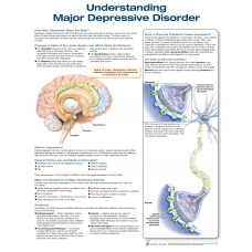 Understanding Depression Chart (52x70cm) With Special Rigid Lamination and Plastic Rollers