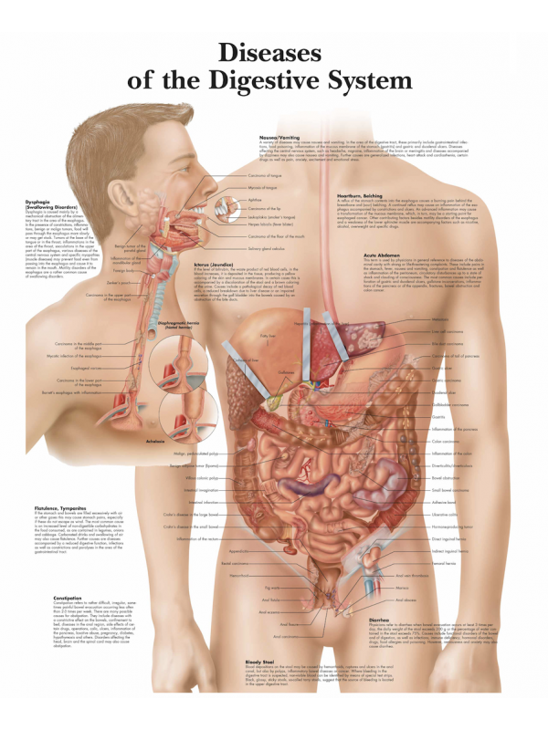 Diseases of the Digestive System Chart (52 × 70 cm, thick glossy paper)