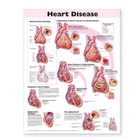 Organ Pathology 5 Charts Bundle - Myaskro