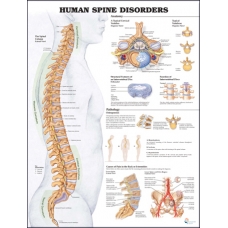 Human Spine Disorders Chart (51x66cm) With Hard Backing, Aluminium Frame & Hanging Hooks