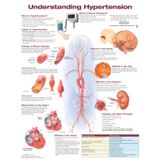 Understanding Hypertension Chart (52x70cm) With Special Rigid Lamination and Plastic Rollers