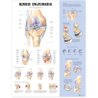 Peripheral Joint 6 Charts Bundle - Myaskro