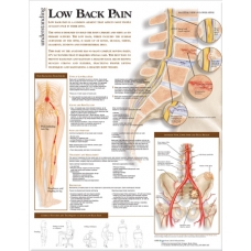 Low Back Pain Chart (52x70cm) With Special Rigid Lamination and Plastic Rollers