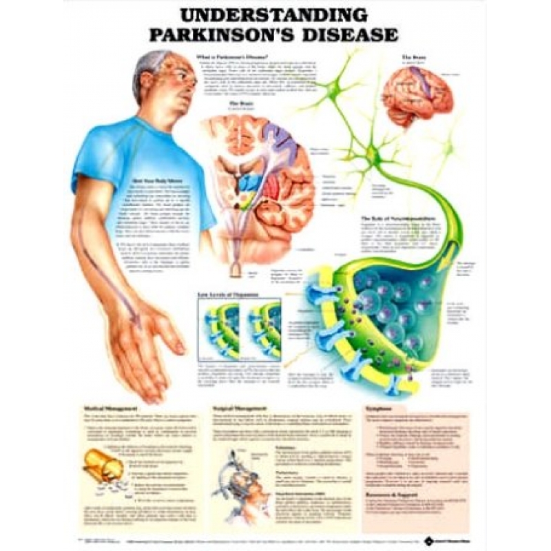 Understanding Parkinson's Disease Chart (52x70cm) With Special Rigid Lamination and Plastic Rollers