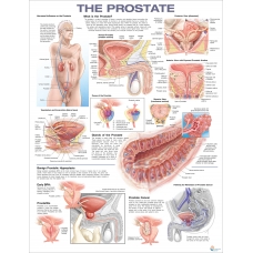 Prostate Chart (51x66cm) With Hard Backing, Aluminium Frame & Hanging Hooks