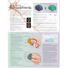 Understanding Schizophrenia Chart (52x70cm) With Special Rigid Lamination and Plastic Rollers