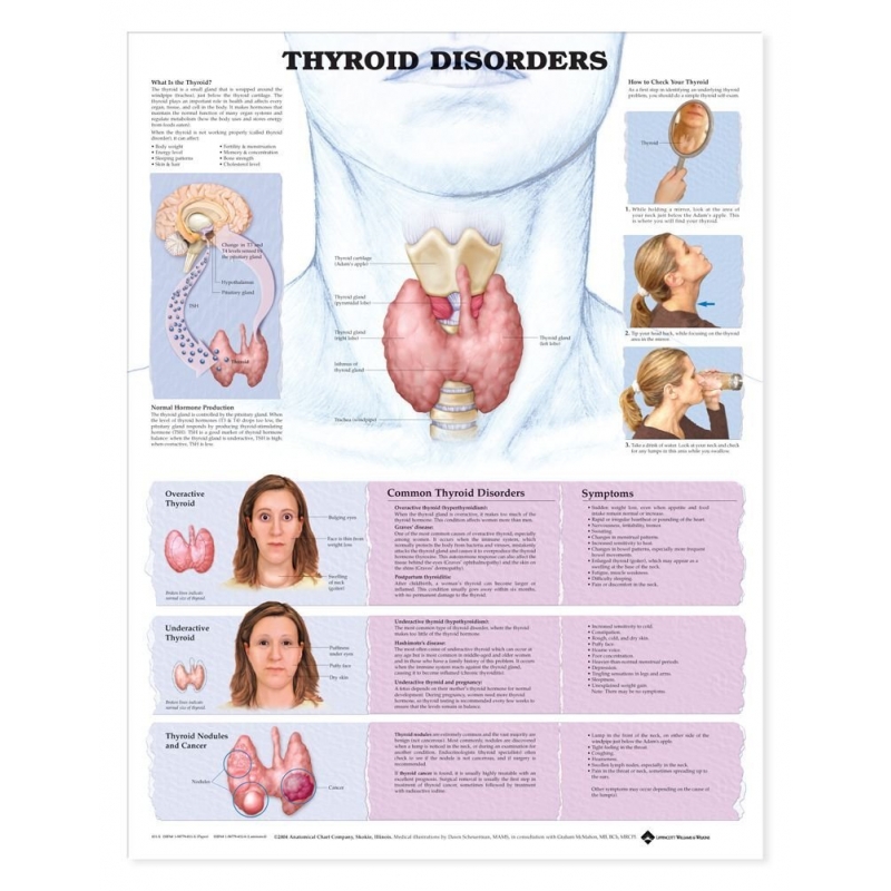 The Thyroid Disorder Chart (52x70cm) With Special Rigid Lamination and Plastic Rollers