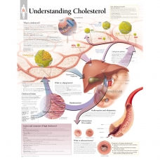 Understanding Cholesterol Chart (52x70cm) With Special Rigid Lamination and Plastic Rollers