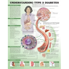 Understanding Diabetes Type 2 Chart (52x70cm) With Special Rigid Lamination and Plastic Rollers