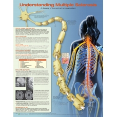 Understanding Multiple Sclerosis Chart (52x70cm) With Special Rigid Lamination and Plastic Rollers