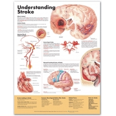 Understanding Stroke Chart (52x70cm) With Special Rigid Lamination and Plastic Rollers