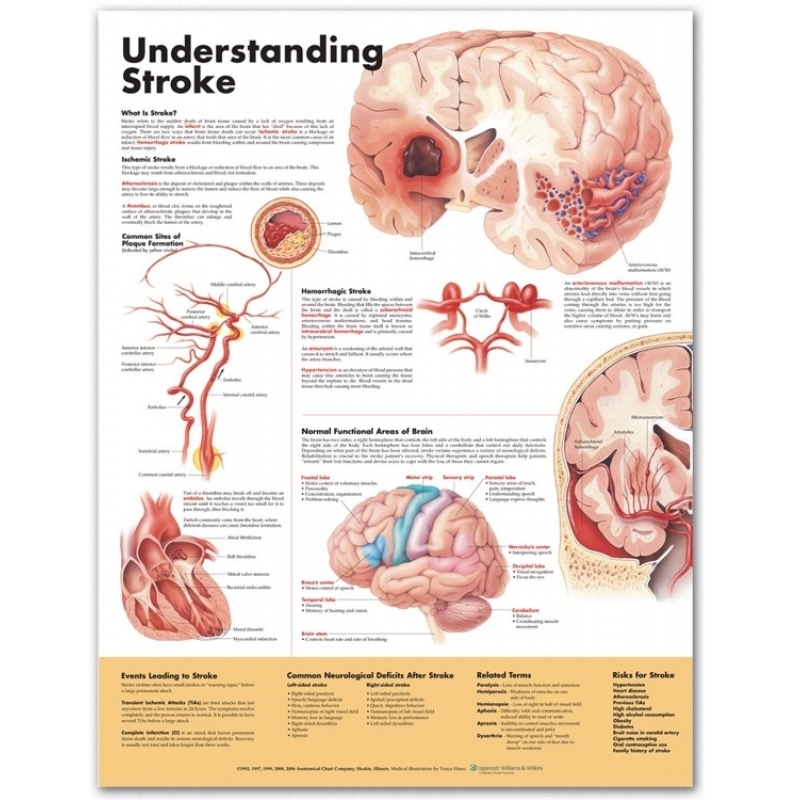 Understanding Stroke Chart (52x70cm) With Special Rigid Lamination and Plastic Rollers