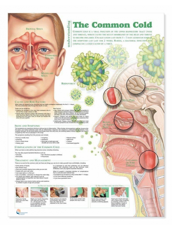 Common Cold Chart (51x66cm) With Hard Backing, Aluminium Frame & Hanging Hooks