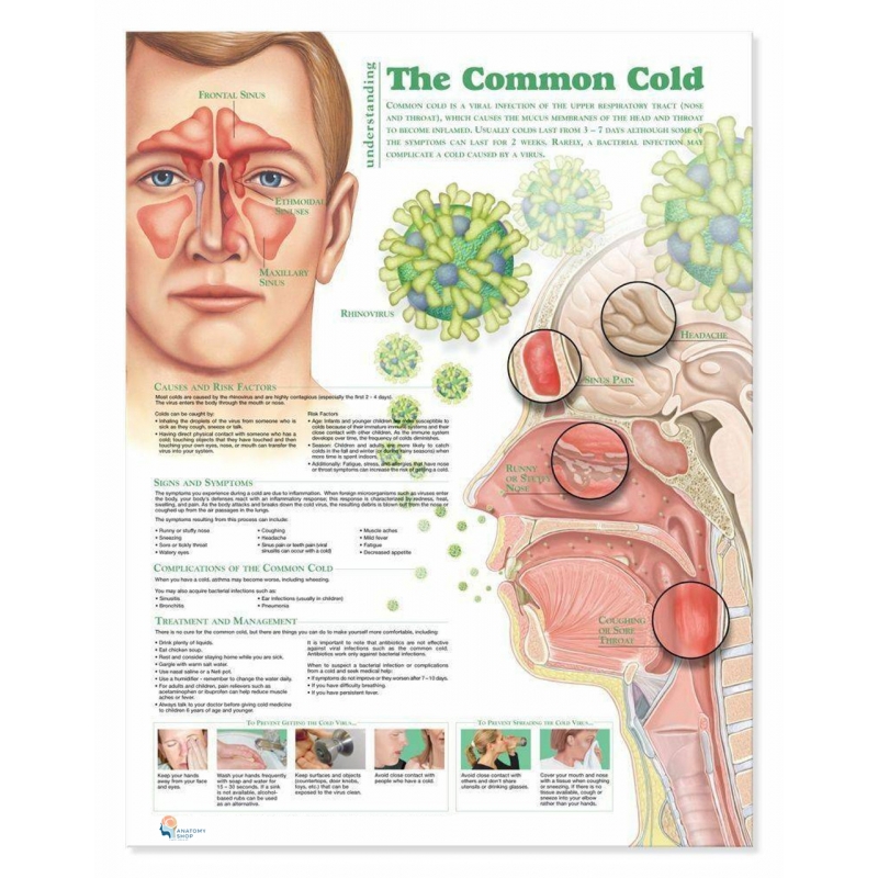 Common Cold Chart (51x66cm) With Hard Backing, Aluminium Frame & Hanging Hooks