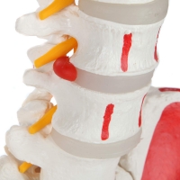 Flexible Spine Model With Femur Heads, Nerves, Occipital Plate And Painted Muscles Origins & Insertion Points