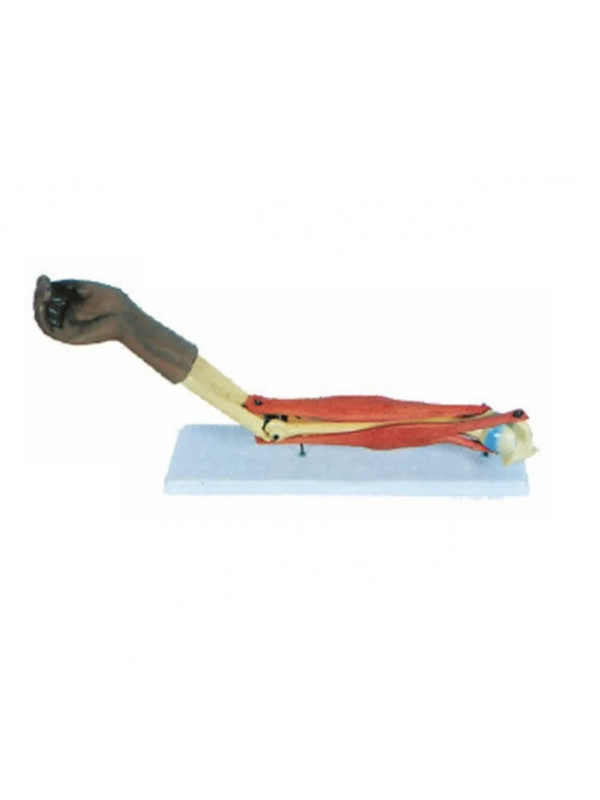 Functional Elbow Joint Model - MYASKRO