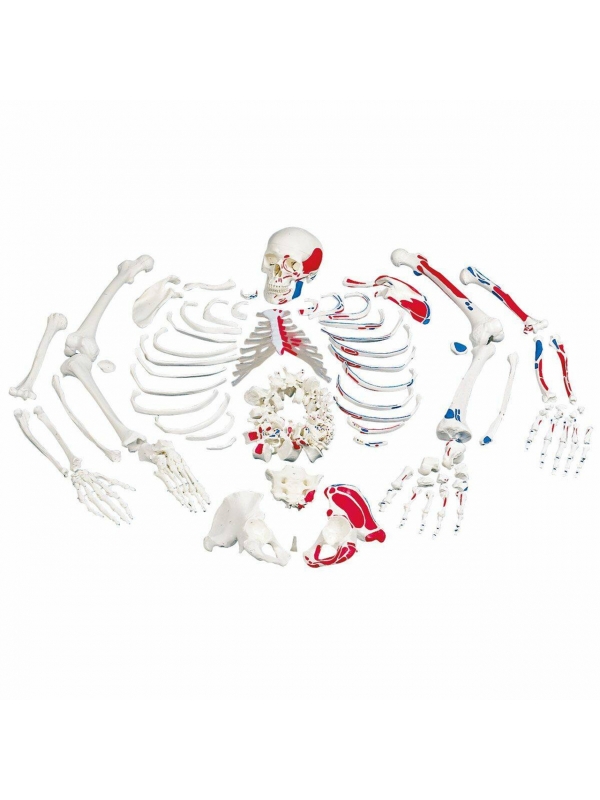 Disarticulated Human Skeleton Painted To Show Muscles Origins and Insertions Bi-Lateral Boneset