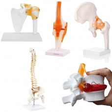 Orthopedic Joint & Spine Anatomy Model Bundle – Includes Spine, Knee, Shoulder, Hip, and Lumbar Disc Herniation Models - Myaskro