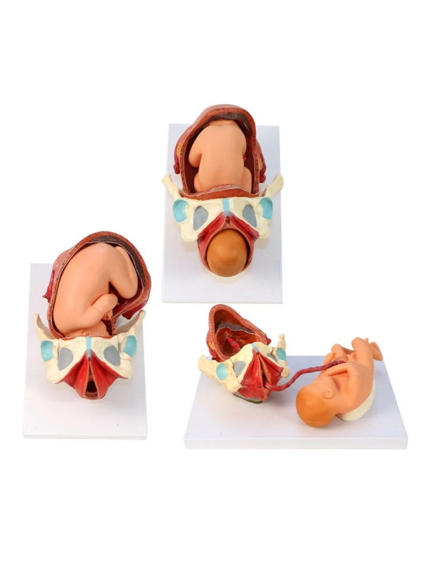Birth Model Set (3-Part) — Demonstration Model of Childbirth | MYASKRO