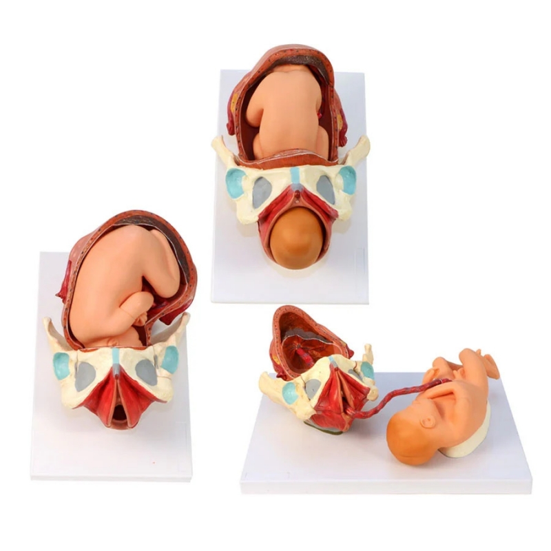 Birth Model Set (3-Part) — Demonstration Model of Childbirth | MYASKRO