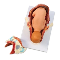 Birth Model Set (3-Part) — Demonstration Model of Childbirth | MYASKRO