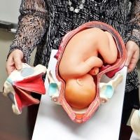 Birth Model Set (3-Part) — Demonstration Model of Childbirth | MYASKRO