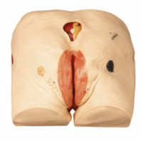 Pressure Ulcers Bundle - Myaskro