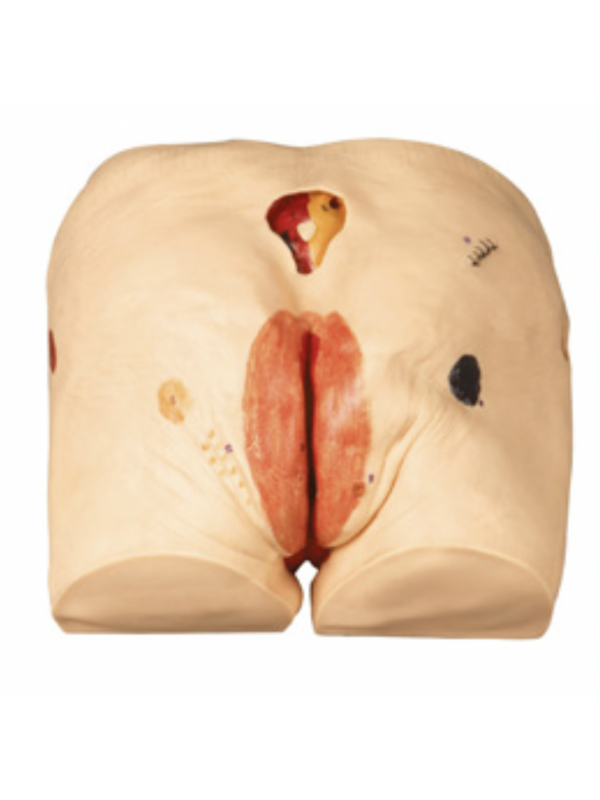 Decubitus Ulcer Care Simulator By Myaskro (Premium Quality)