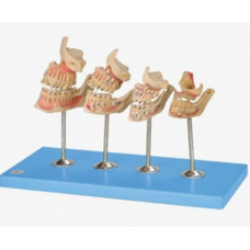 Development of a set of Teeth - Dental Model