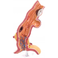 Esophagus Model - Myaskro