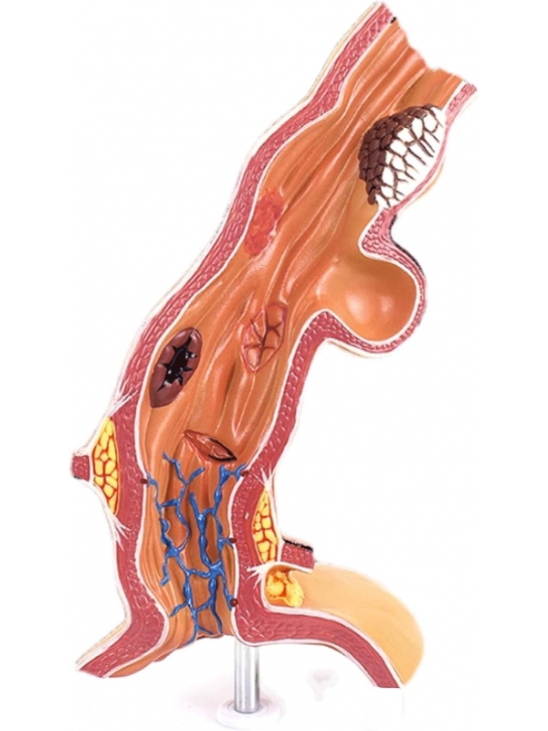 Esophagus Model - Myaskro